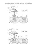 HEMOSTASIS DEVICE AND METHOD FOR USING THE SAME diagram and image