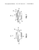 Spinal Column Correction Device diagram and image