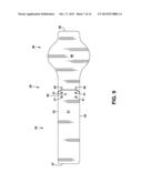 Spinal Column Correction Device diagram and image