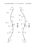 Spinal Column Correction Device diagram and image