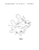 ORTHOPAEDIC DEVICE AND METHODS FOR ITS PRE-ASSEMBLY AND ASSEMBLY diagram and image