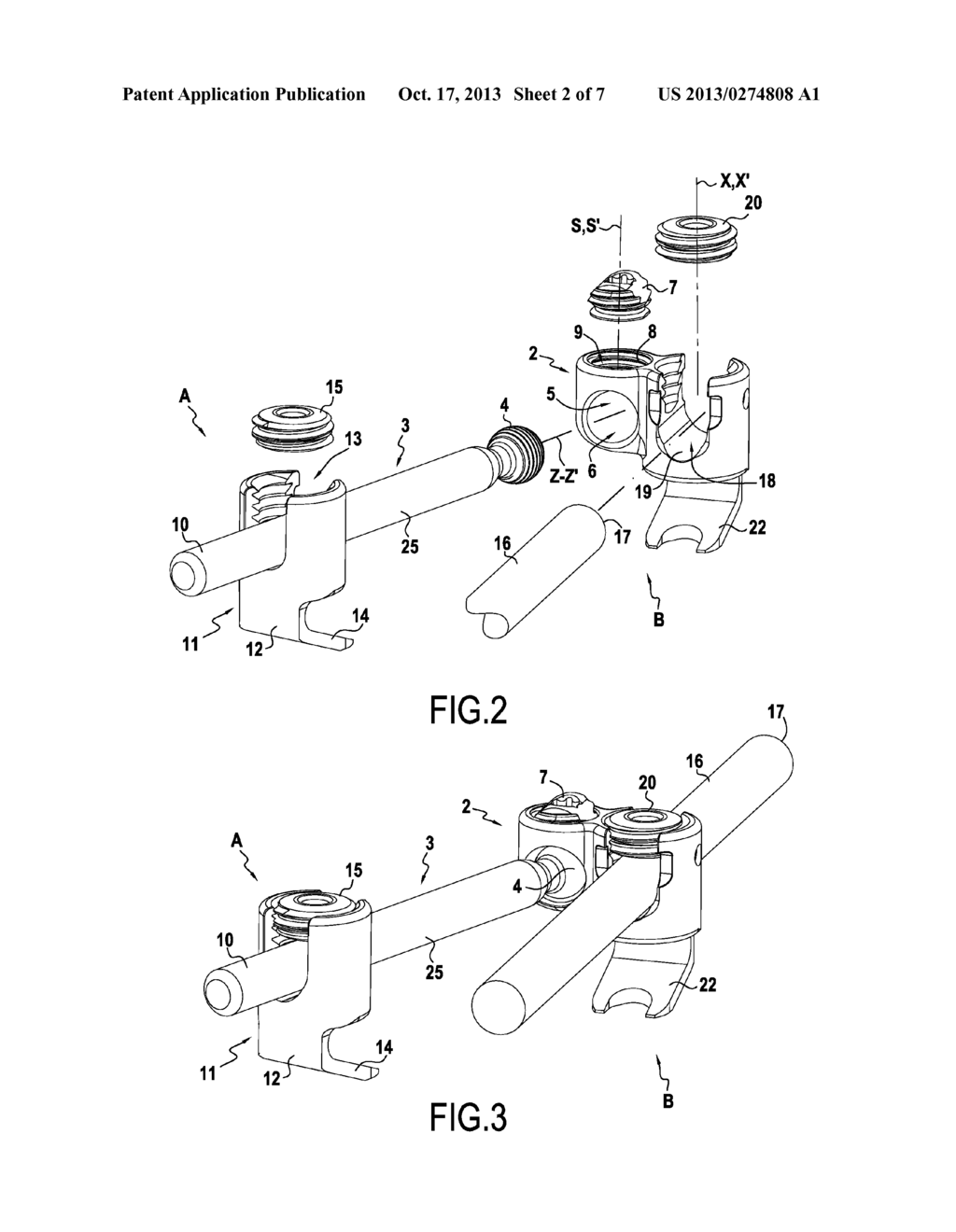 ORTHOPAEDIC DEVICE AND METHODS FOR ITS PRE-ASSEMBLY AND ASSEMBLY - diagram, schematic, and image 03