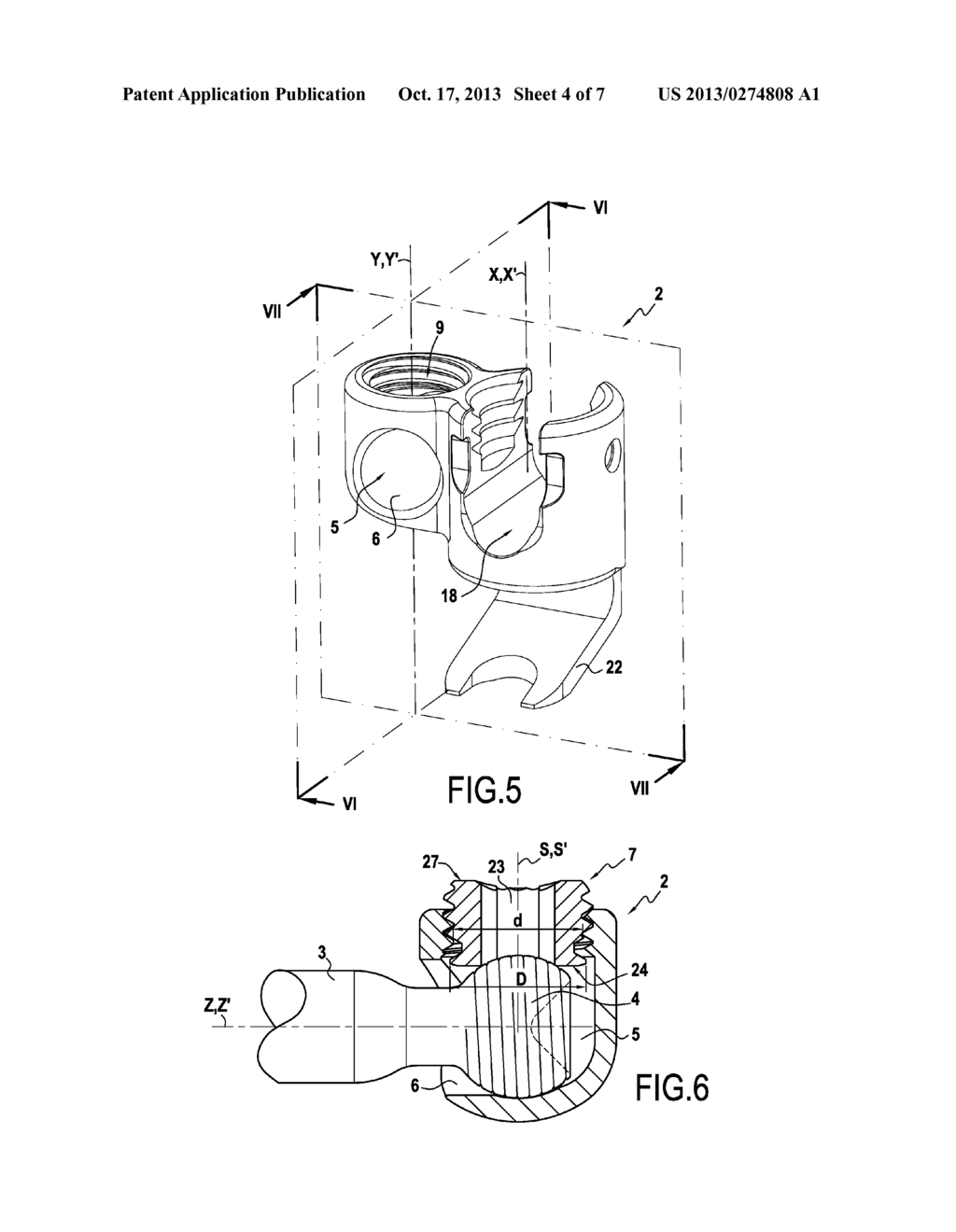 ORTHOPAEDIC DEVICE AND METHODS FOR ITS PRE-ASSEMBLY AND ASSEMBLY - diagram, schematic, and image 05