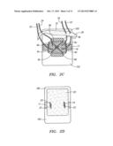 METHODS AND APPARATUS FOR STABILIZING A SPINAL SEGMENT diagram and image