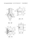 METHODS AND APPARATUS FOR STABILIZING A SPINAL SEGMENT diagram and image