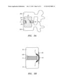 METHODS AND APPARATUS FOR STABILIZING A SPINAL SEGMENT diagram and image