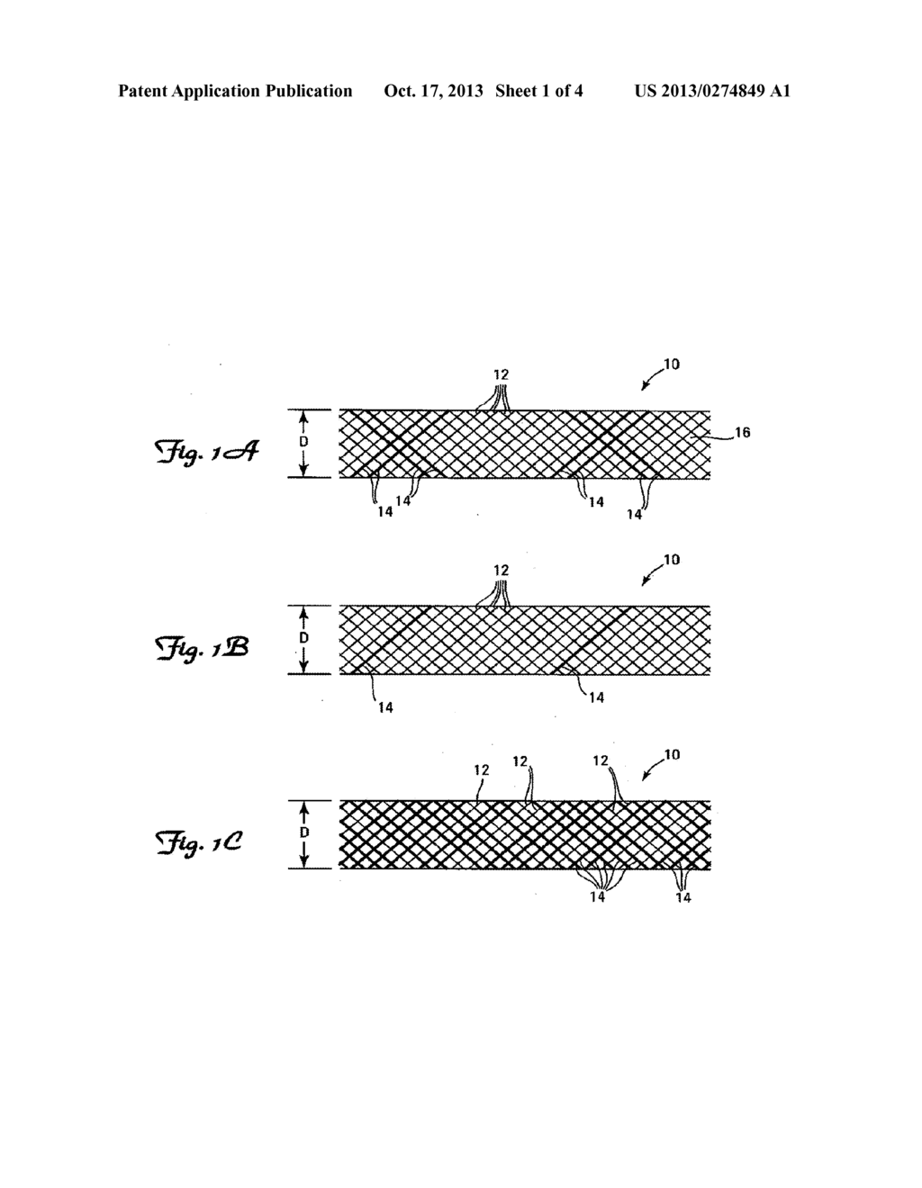 STENTS HAVING RADIOPAQUE MESH - diagram, schematic, and image 02