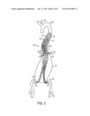 Visceral Double-Barreled Main Body Stent Graft and Methods for Use diagram and image