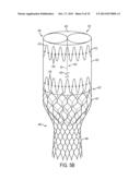 Visceral Double-Barreled Main Body Stent Graft and Methods for Use diagram and image