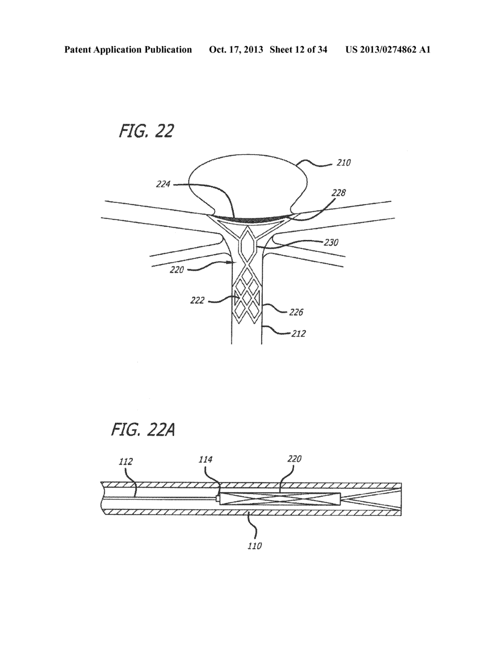 METHODS AND DEVICES FOR TREATMENT OF VASCULAR DEFECTS - diagram, schematic, and image 13