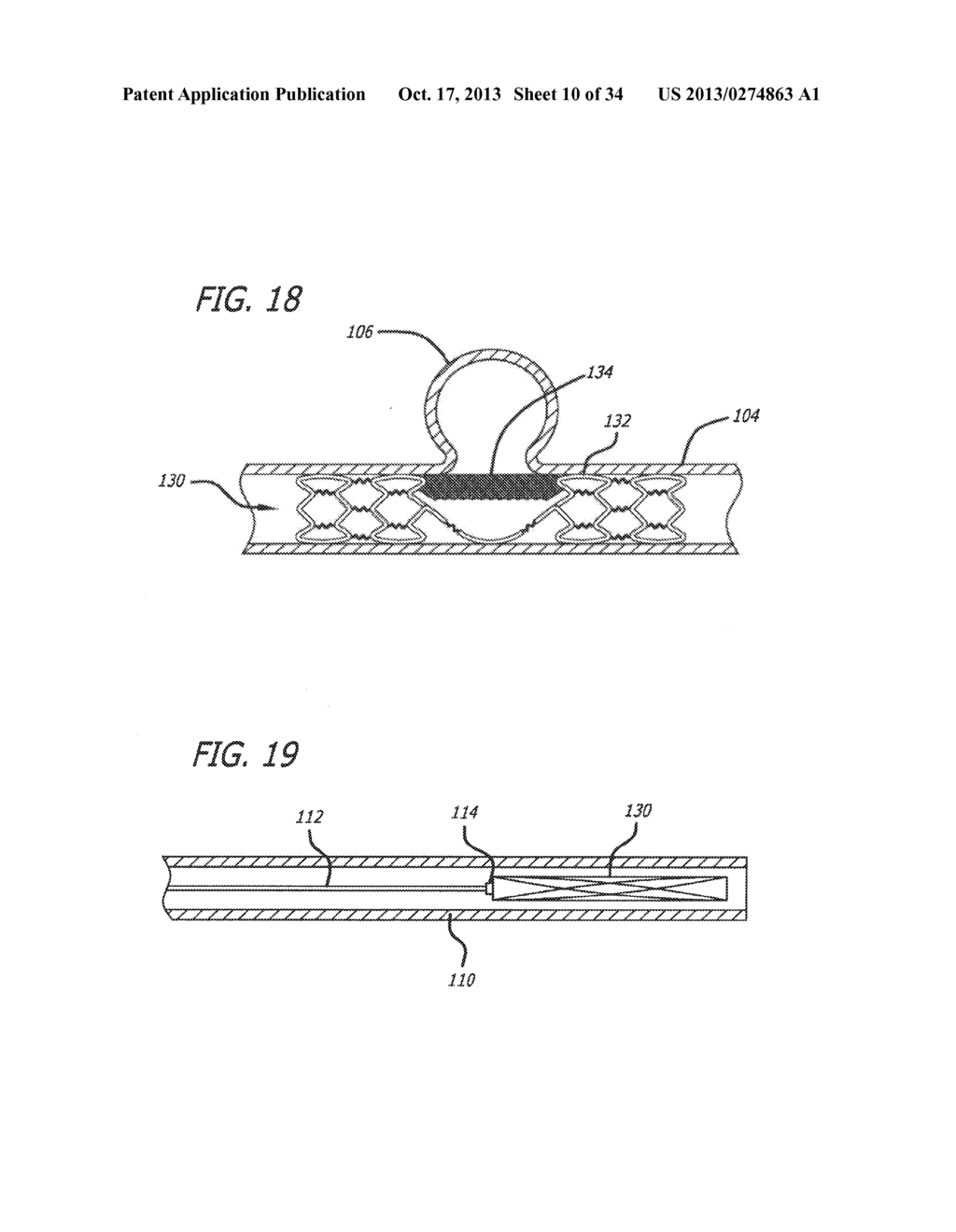 METHODS AND DEVICES FOR TREATMENT OF VASCULAR DEFECTS - diagram, schematic, and image 11