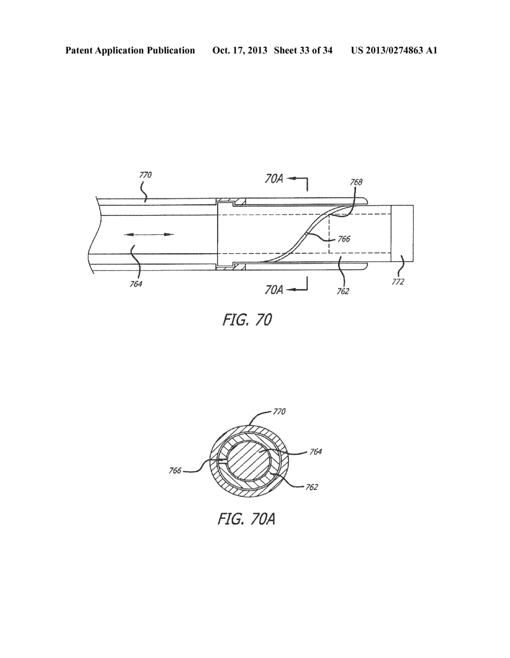 METHODS AND DEVICES FOR TREATMENT OF VASCULAR DEFECTS - diagram, schematic, and image 34