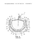 RESIZABLE VALVE BASE FOR CARDIOVASCULAR VALVE ASSEMBLY diagram and image