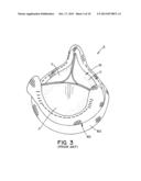 RESIZABLE VALVE BASE FOR CARDIOVASCULAR VALVE ASSEMBLY diagram and image