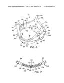 RESIZABLE VALVE BASE FOR CARDIOVASCULAR VALVE ASSEMBLY diagram and image