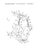 RESIZABLE VALVE BASE FOR CARDIOVASCULAR VALVE ASSEMBLY diagram and image