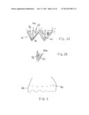 Transcatheter Stent-Valves and Methods, Systems and Devices for Addressing     Para-Valve Leakage diagram and image