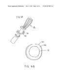 Transcatheter Stent-Valves and Methods, Systems and Devices for Addressing     Para-Valve Leakage diagram and image