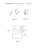 Transcatheter Stent-Valves and Methods, Systems and Devices for Addressing     Para-Valve Leakage diagram and image