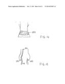 Transcatheter Stent-Valves and Methods, Systems and Devices for Addressing     Para-Valve Leakage diagram and image