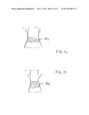 Transcatheter Stent-Valves and Methods, Systems and Devices for Addressing     Para-Valve Leakage diagram and image