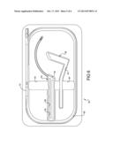 Catheter for Inserting A Voice Prosthesis diagram and image