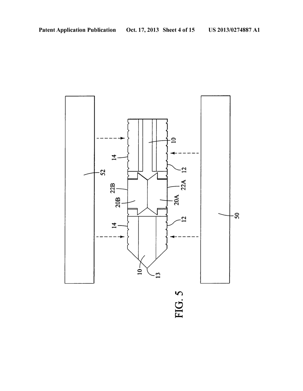 Stackable Spinal Support System - diagram, schematic, and image 05