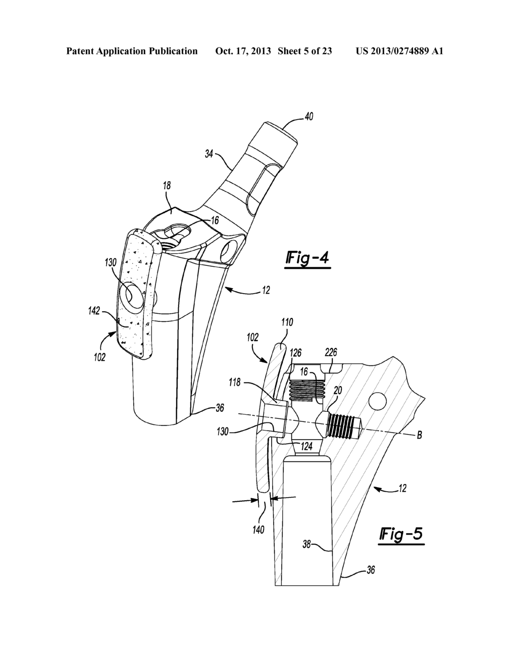 Modular Lateral Hip Auguments - diagram, schematic, and image 06