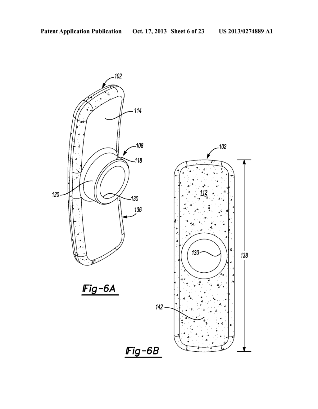 Modular Lateral Hip Auguments - diagram, schematic, and image 07