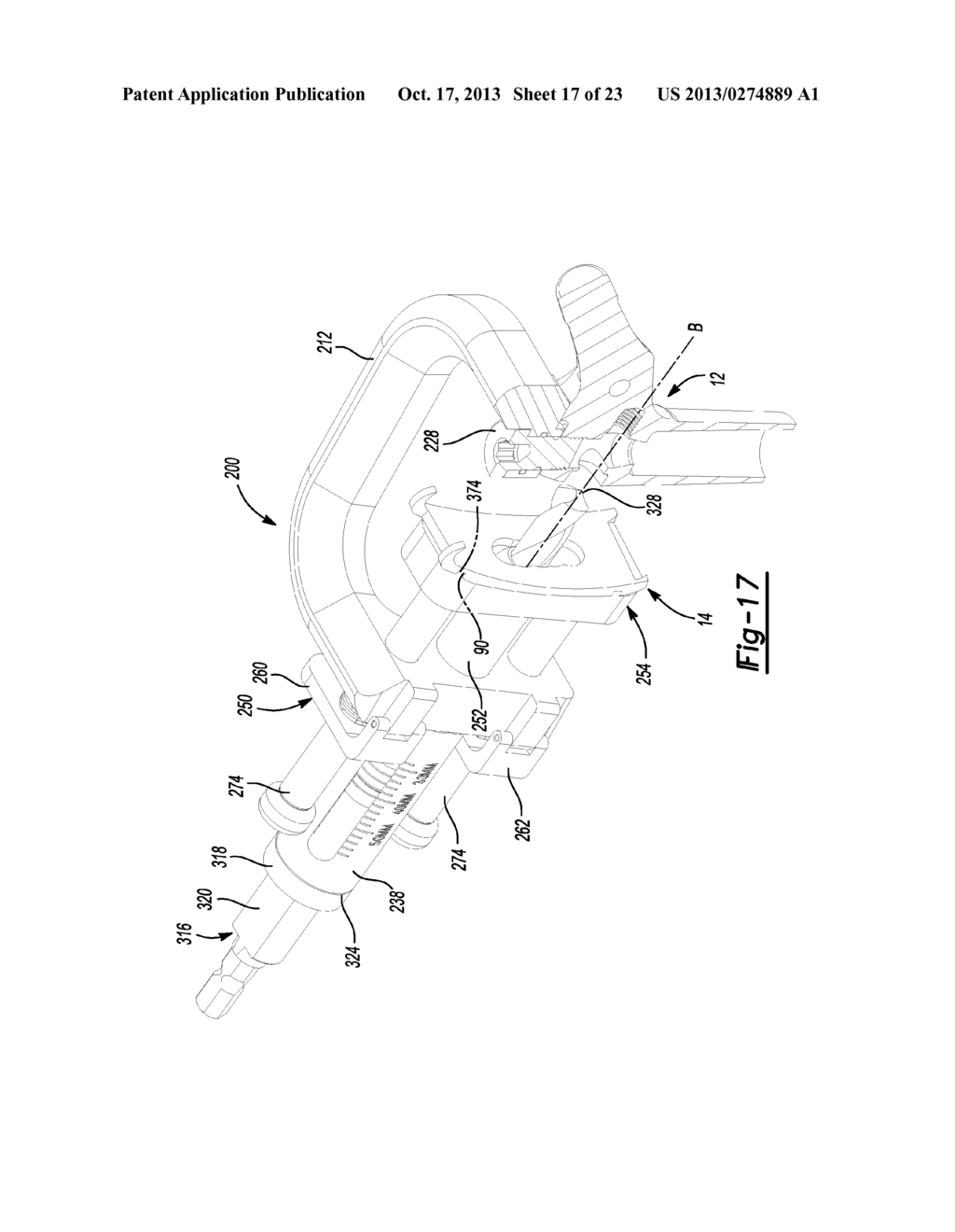 Modular Lateral Hip Auguments - diagram, schematic, and image 18