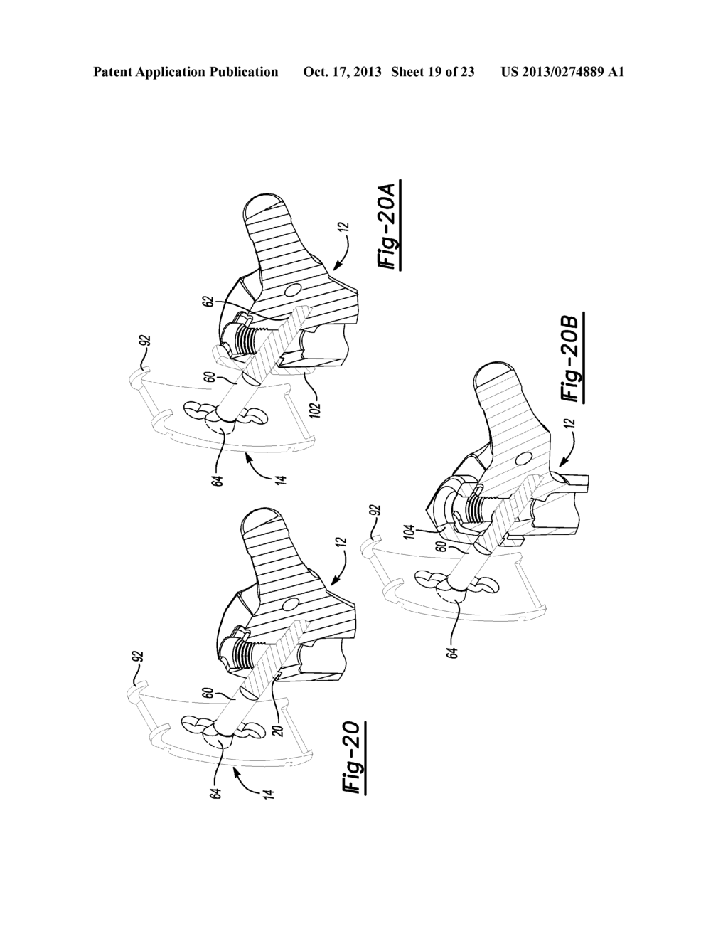 Modular Lateral Hip Auguments - diagram, schematic, and image 20