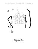 Systems and Methods of Retopologizing Graphical Data diagram and image