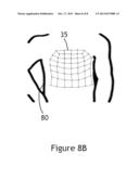 Systems and Methods of Retopologizing Graphical Data diagram and image