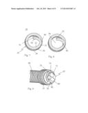 WIRE THREAD INSERT WITH REDRESSABLE MOUNTING TANG AS WELL AS ITS     MANUFACTURING AND INSTALLATION diagram and image