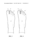 Toe Spacer Sock and Corrective Footwear diagram and image