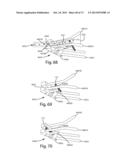 FASTENER, INSTALLATION TOOL AND RELATED METHOD OF USE diagram and image