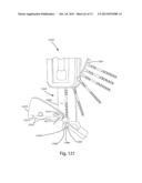 FASTENER, INSTALLATION TOOL AND RELATED METHOD OF USE diagram and image