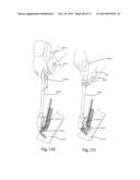 FASTENER, INSTALLATION TOOL AND RELATED METHOD OF USE diagram and image