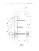 Boat Anchor diagram and image