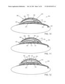 DRUG-DELIVERY PUMPS AND METHODS OF MANUFACTURE diagram and image