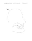 Intraoral Communications and Processing Device diagram and image