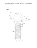 Intraoral Communications and Processing Device diagram and image