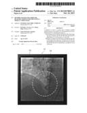 METHOD, SYSTEM AND COMPUTER READABLE MEDIUM FOR PROCESSING A MEDICAL VIDEO     IMAGE diagram and image