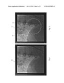 METHOD, SYSTEM AND COMPUTER READABLE MEDIUM FOR PROCESSING A MEDICAL VIDEO     IMAGE diagram and image