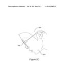 Adjustment device for eyeglasses diagram and image