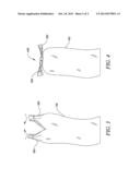 BAG CLOSURE CONSTRUCTION diagram and image