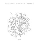 AXIALLY-SPLIT RADIAL TURBINE diagram and image