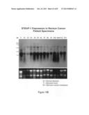 Antibodies and molecules derived therefrom that bind to STEAP-1 proteins diagram and image