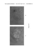 COMPOSITIONS FOR USE IN TREATMENT OF DERMATOLOGICAL DISEASES AND     CONDITIONS AND METHODS OF USE THEREOF diagram and image