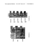 METHOD FOR TREATING TYPE 1 DIABETES diagram and image